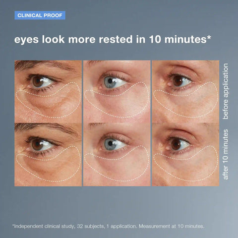 awaken peptide depuffing eye gel