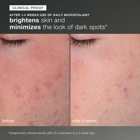 discover healthy skin kit