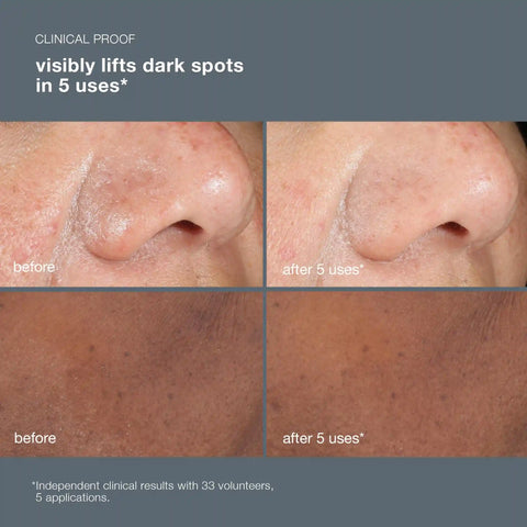 powerbright dark spot peel