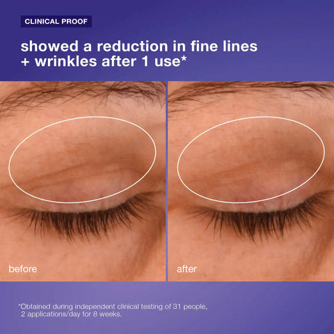 phyto nature lifting eye cream