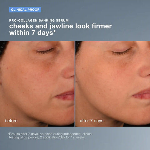 collagen preservation duo (2 full-size)