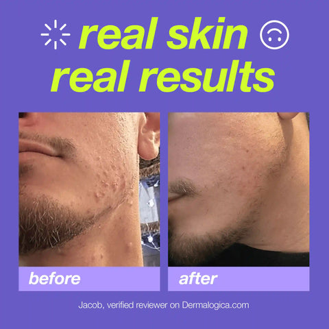 breakout clearing foaming wash