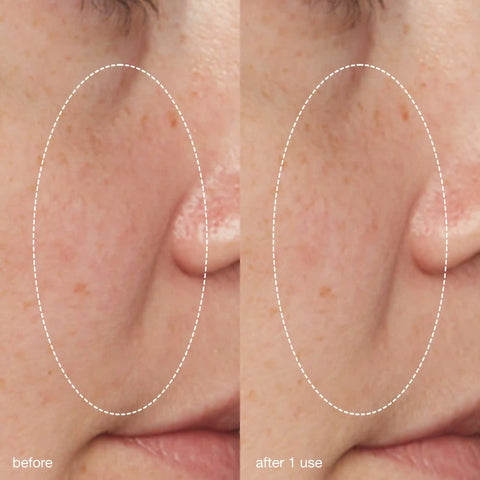 liquid peelfoliant