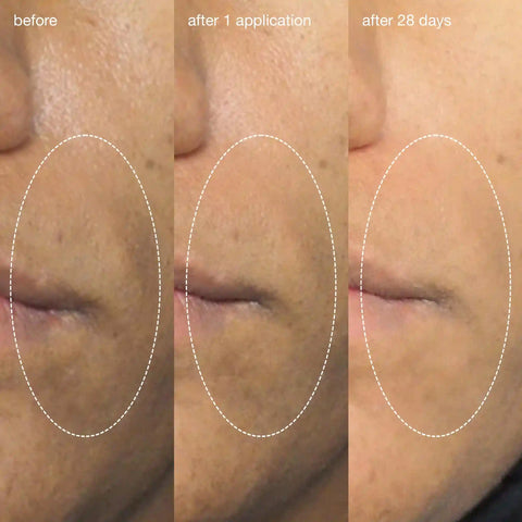 liquid peelfoliant